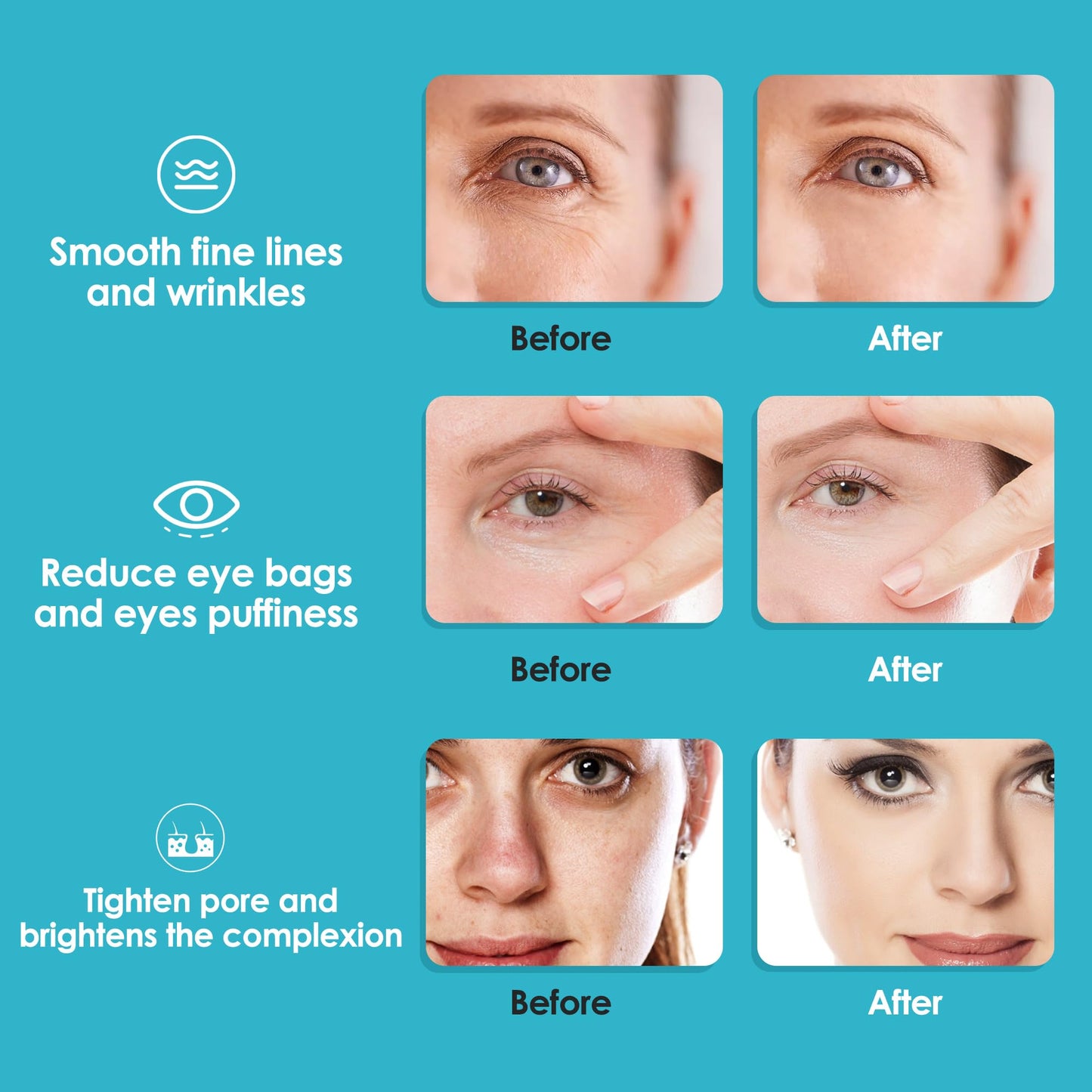 Lazzybeauty Ice Globes for Facials, Ice Globes, Facial Ice Globes, Cooling Globes, Globes for Face Neck & Eyes, Daily Beauty, Tighten Skin, Anti Ageing, Reduce Puffy and Wrinkle, Blue