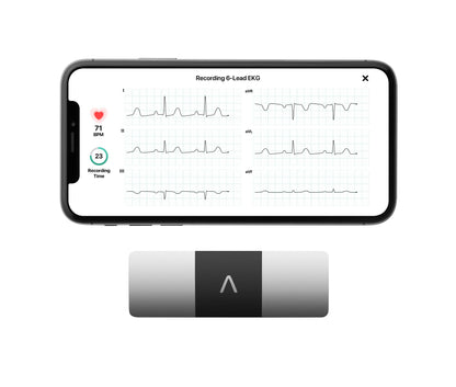 KardiaMobile 6-Lead Personal EKG Monitor – Six Views of The Heart – Detects AFib and Irregular Arrhythmias – Instant Results in 30 Seconds – Works with Most Smartphones