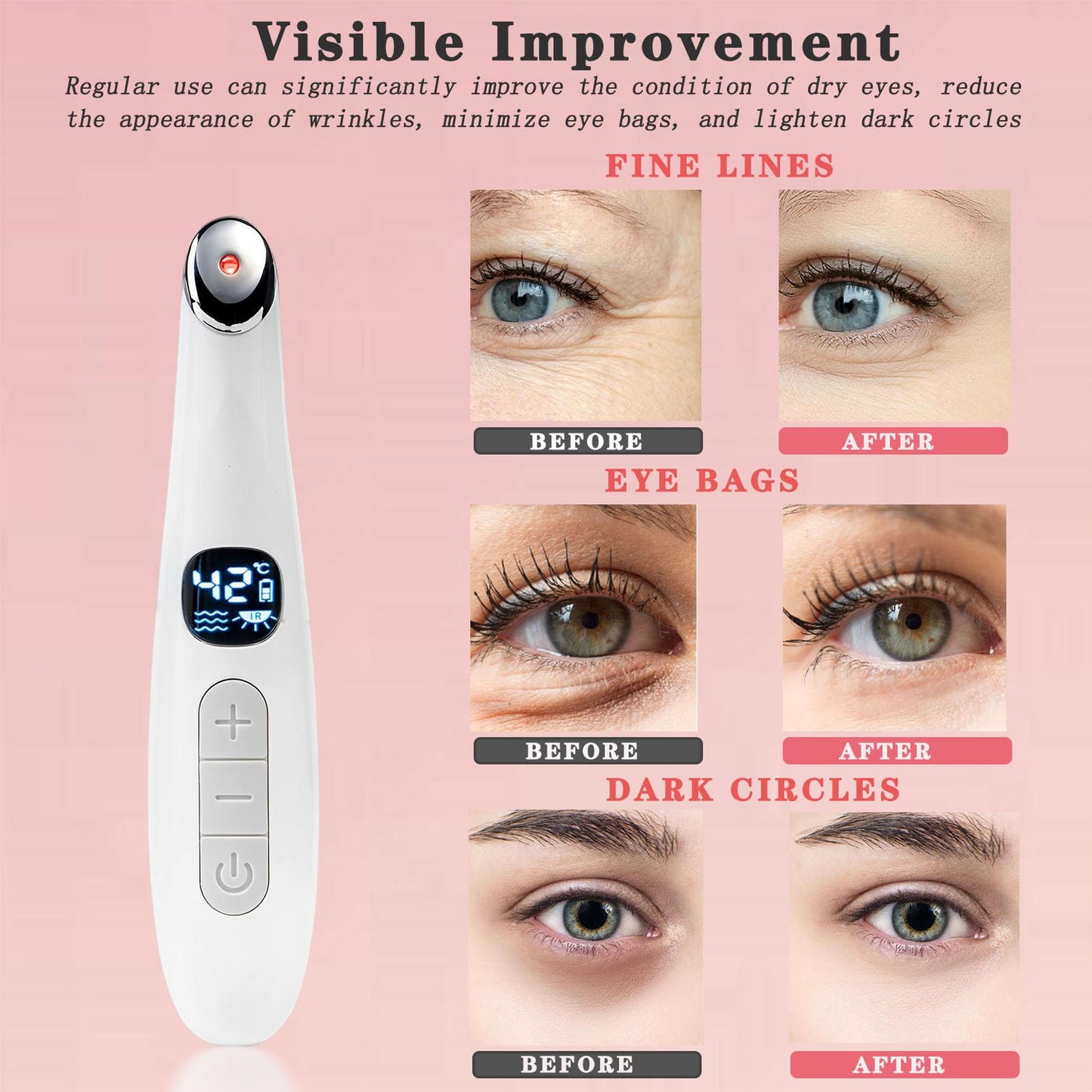 Vowleike Eye Lift Wand, 3 in 1 Vibrating Red Light 98°F to 113°F LCD Display Eye Massager for Dry Eyes, Dark Circles and Puffiness, Electrical Face, Neck Sculpting Pen for Fine Lines and Wrinkles