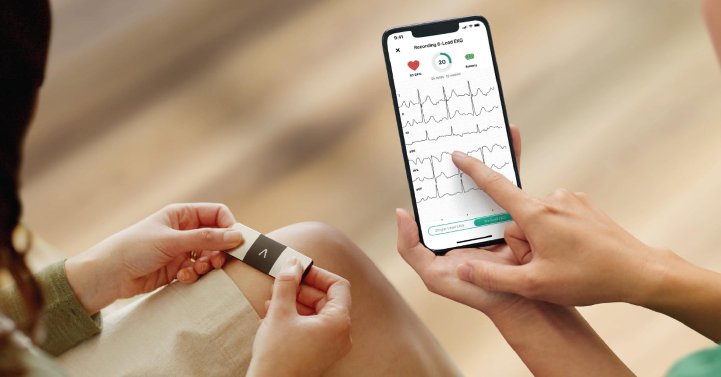 KardiaMobile 6-Lead Personal EKG Monitor – Six Views of The Heart – Detects AFib and Irregular Arrhythmias – Instant Results in 30 Seconds – Works with Most Smartphones