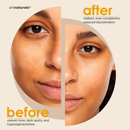 Kojic Acid Soap + African Net Sponge (2 pack X 142g Turmeric bars) Dark spot remover & Scars - Original Japanese Complex Vitamin C, Hyaluronic Acid, retinol, shea butter (Citrus)