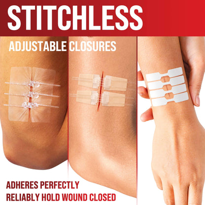 Emergency Wound Closure Strips - 24pk - 3 Types Easy to Use Butterfly Bandages - Stitchless & Painless Laceration Closure Kit